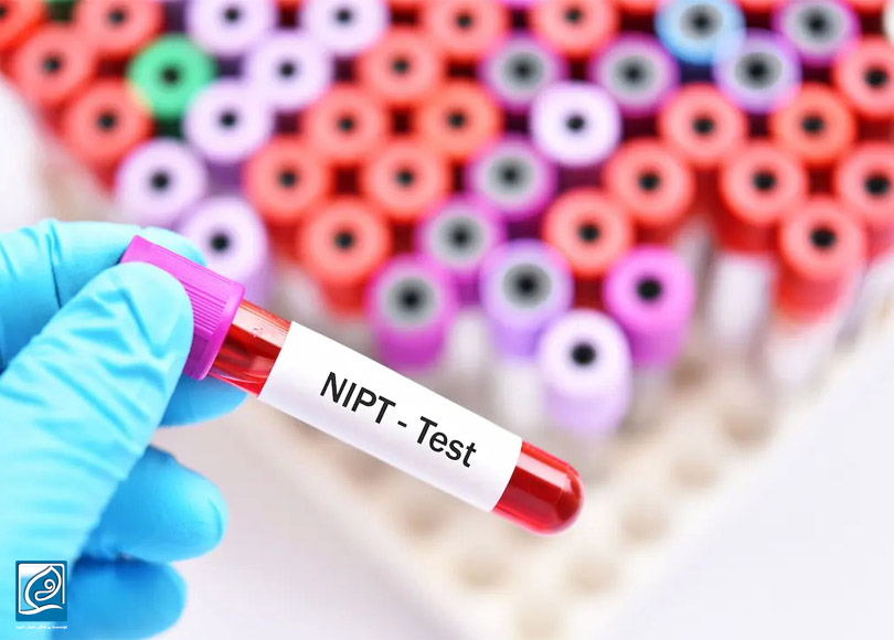 آنچه می بایست در مورد تست NIPT یا سل فری بدانیم!